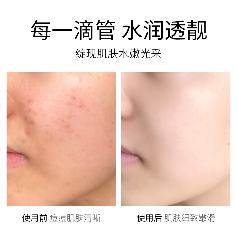形象美熊果苷美白精华液 补水精华滋润美白肌肤保湿补水30ml/瓶高清大图