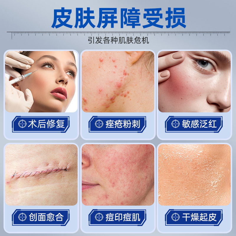 医用重组三型人源化胶原蛋白修护凝胶修复痘印痤疮烫伤美容术后疤20g/支高清大图