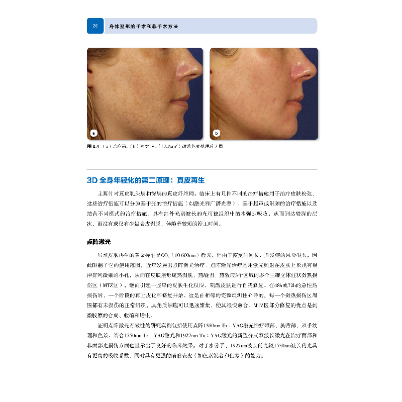 醉染图书身体塑形的手术和非手术方法9787559116529高清大图