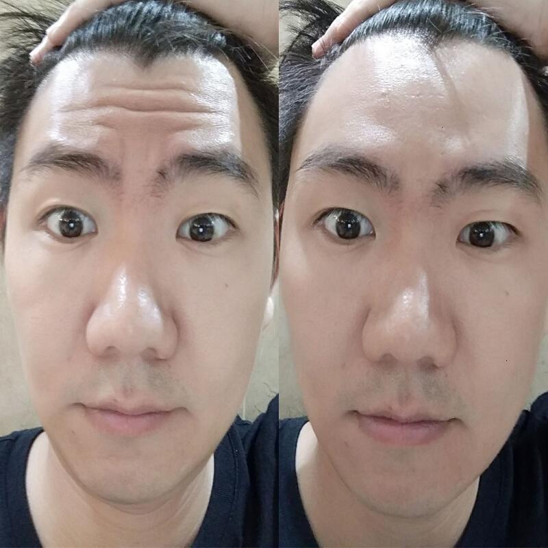 去除抬头纹祛皱男士克星精华液面部皱纹去细纹提拉紧致