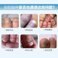 去除灰指甲液灰甲清病甲灰甲指专用药修复液非药水药膏德国成膜技术REAM灰指甲生物修护膜 灰指甲1盒3ml