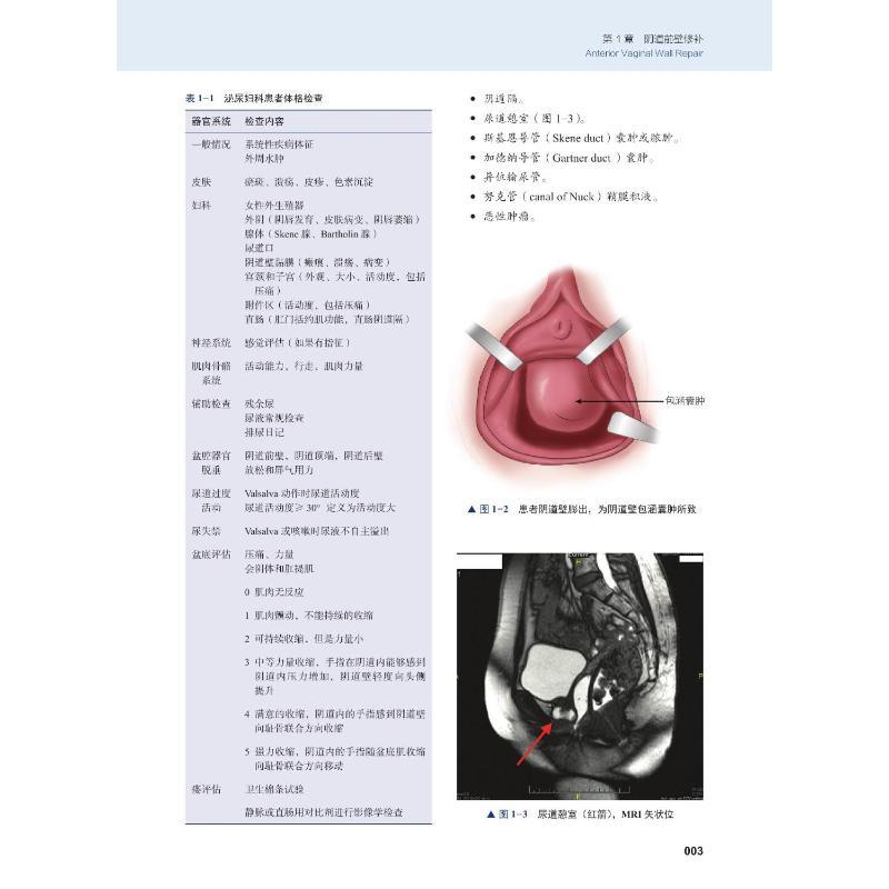 妇科手术技巧 泌尿妇科学 (美)乔纳森·S.贝雷克,(美)克里斯托弗·M.塔内尔 著 乔杰,韩劲松 译 生活 文轩网