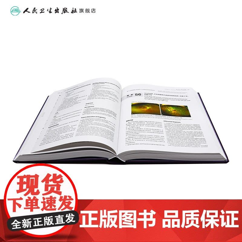 中英对照眼科临床病例荟萃李筱荣林海江眼前节疾病眼视光神经眼科疾病斜视与小儿眼病人民卫生出版社病理诊断病例对照规范化培训书图片