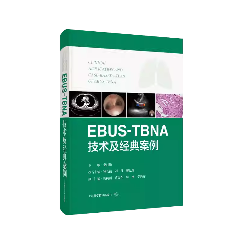 EBUSTBNA技术及经典案例 [正版]EBUSTBNA技术及经典案例 超声内镜引导下经支气管针吸活检术 李时悦主编 上高清大图