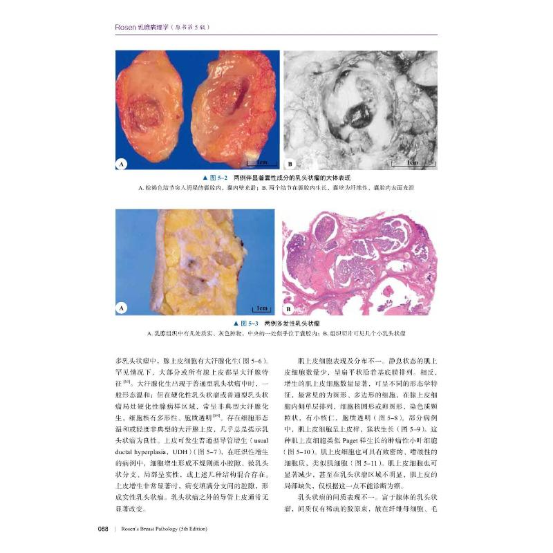醉染图书Rosen乳腺病理学 原书第5版9787504699930高清大图