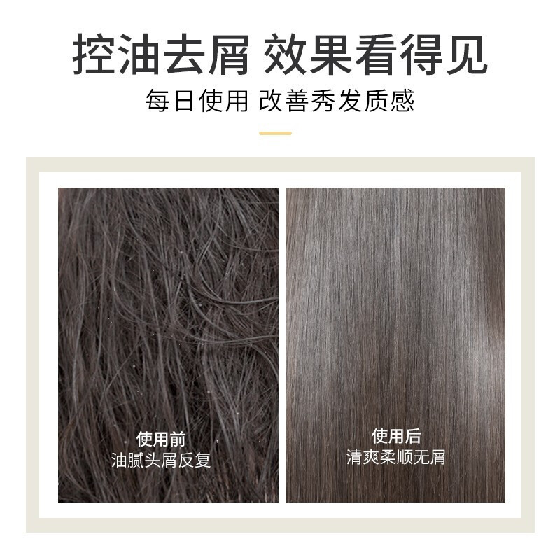 浅香(ASAKA)青春版-木瓜氨基酸沐浴露500g(单位:件)高清大图