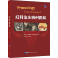 妇科临床病例图解