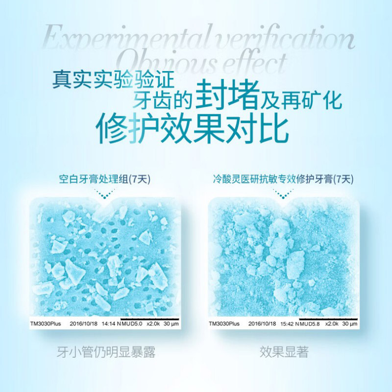 冷酸灵专研抗敏益生菌牙膏140克(新旧包装随机发)高清大图