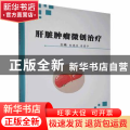 肝脏肿瘤微创治疗