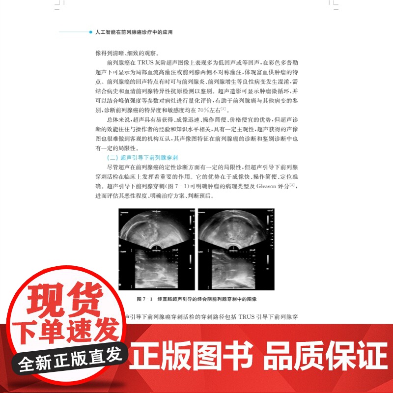 人工智能在前列腺癌诊疗中的应用 AI医学技术应用现状癌症早期诊断治疗效果预测陈锐曹志兴上海科学技术出版社西医泌尿外科临床高清大图
