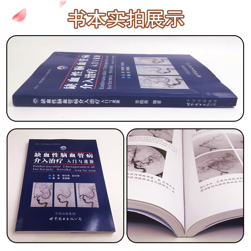 [醉染正版]缺血性脑血管病介入治疗入门与进阶 李晓青著 基础入门脑血管解剖造影临床基础脑卒中神经介入医生用书医学书籍 世高清大图