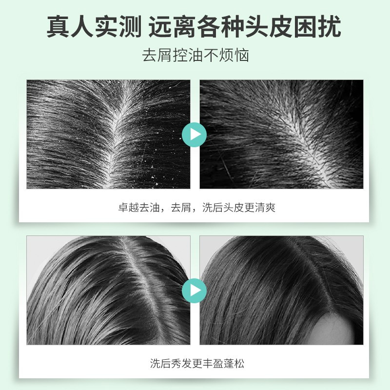 柏缇POTE海藻益生菌去屑洗发水475ml+海藻维生素E护发素475ml套装_107630