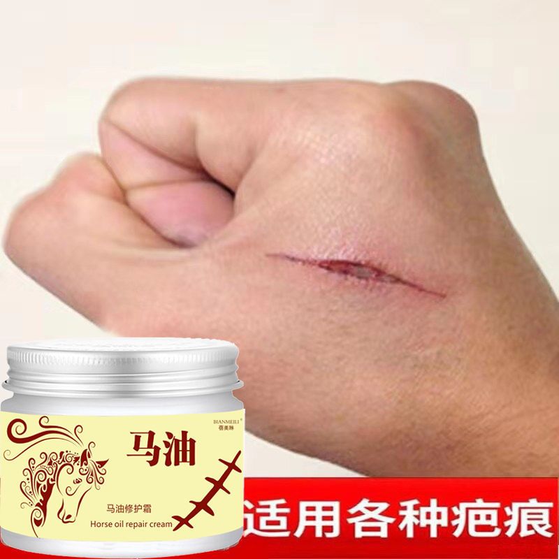 祛疤神器去疤膏凹凸疤烫伤妊娠纹修护霜淡化疤痕痘印祛疤膏祛疤膏1