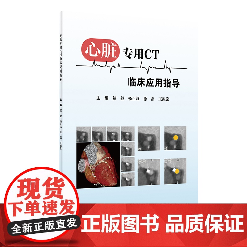 心脏专用CT临床应用指导高清大图