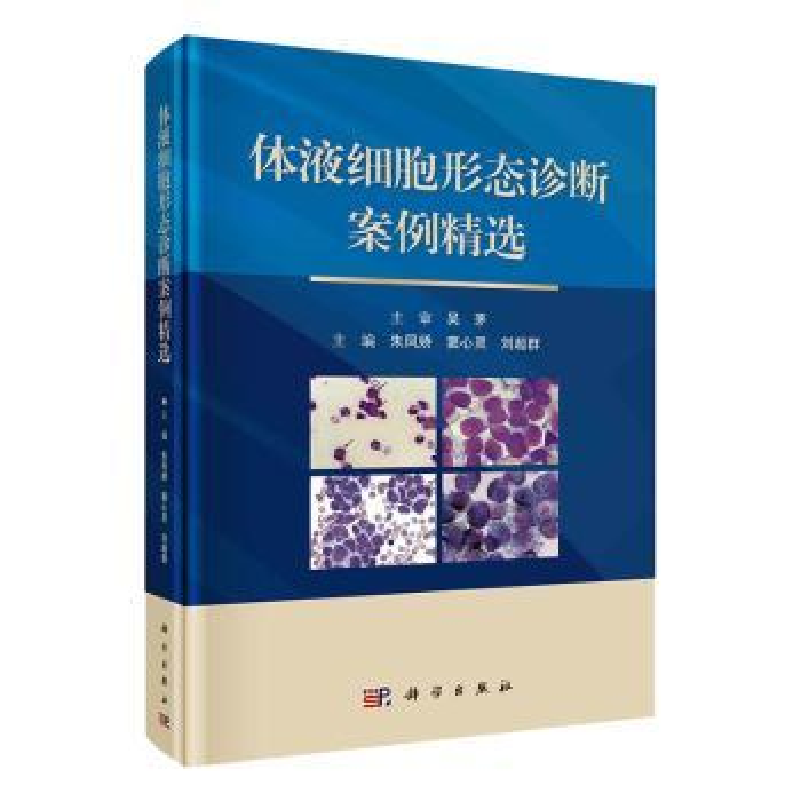 音像体液细胞形态诊断案例精选朱凤娇,窦心灵,刘超群