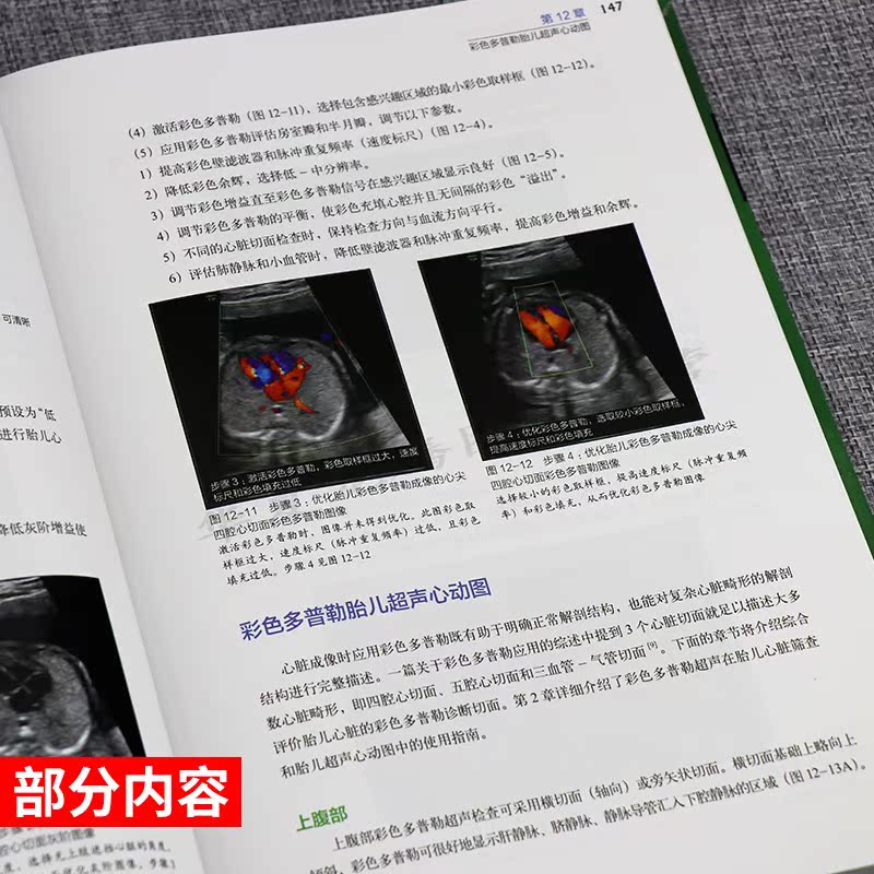 [正版]胎儿超声心动图实用指南 正常和异常心脏 第三版 妇产科学医学类书籍 胎儿心脏畸形诊断临床检查 刘琳主译 北京科学高清大图