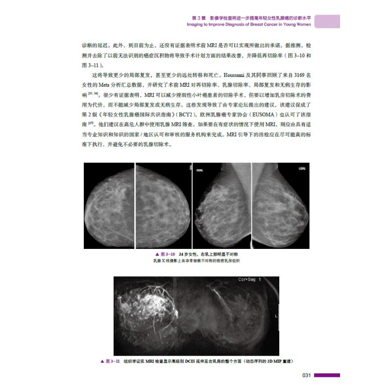 醉染图书年轻女乳腺癌9787504689702高清大图