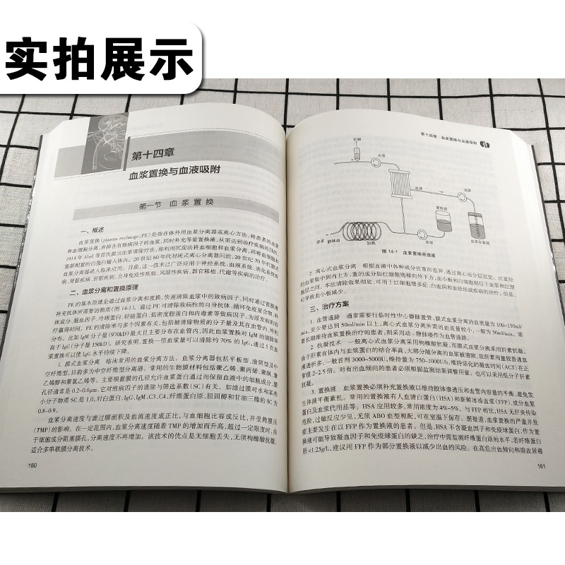 [正版] 连续性肾脏替代治疗 主编付平 肾内科 急诊科 重症医学参考工具书籍 血液透析净化技术教程 人民卫生出版社97高清大图