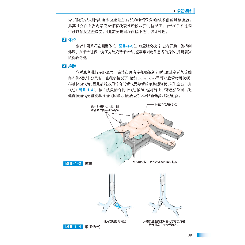 醉染图书癌症标准手术图解——食管癌9787571409760高清大图
