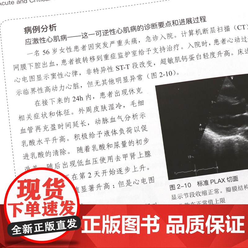 急危重症超声心动图学 危重症心脏左右心结构及心功能 适合广大急诊科 重症医学科 心脏病科医师参考阅读 中国科学技术高清大图