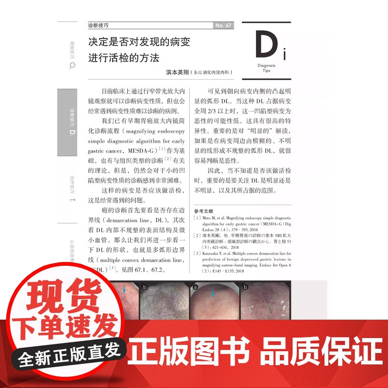 [央视网]消化内镜应用提升技巧 教科书中没有讲到的观察诊断和治疗要点124位专科医生执笔 全方位提升消化内镜应用技能赠视高清大图