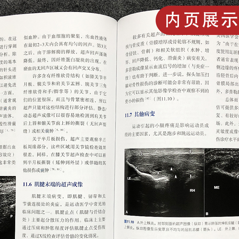 [醉染正版]正版 肌骨超声 物理与康复医学临床实践指南康复学与临床学书籍经典肌骨超声教科书 关节评估与常见疾病 仪高清大图