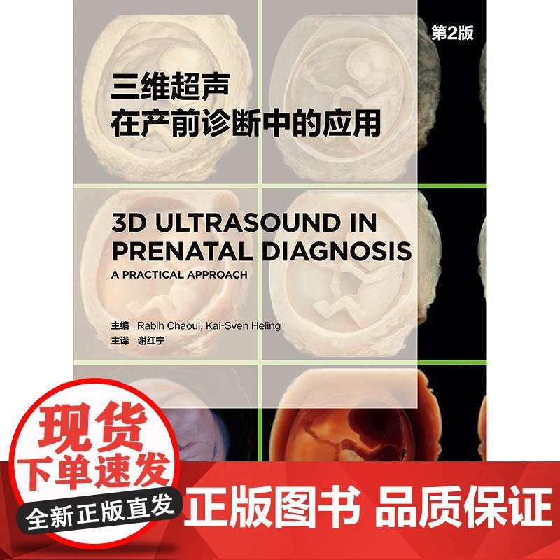 三维超声在产前诊断中的应用(第2版)高清大图