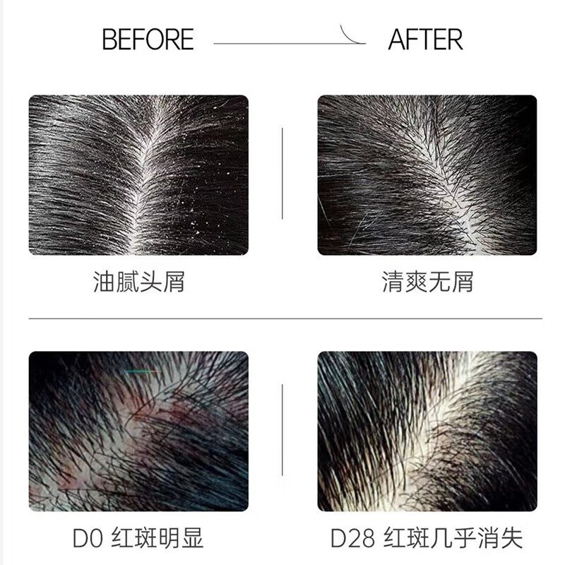 Spes诗裴丝红没药醇多肽控油蓬松去屑止痒洗护500ml*2高清大图