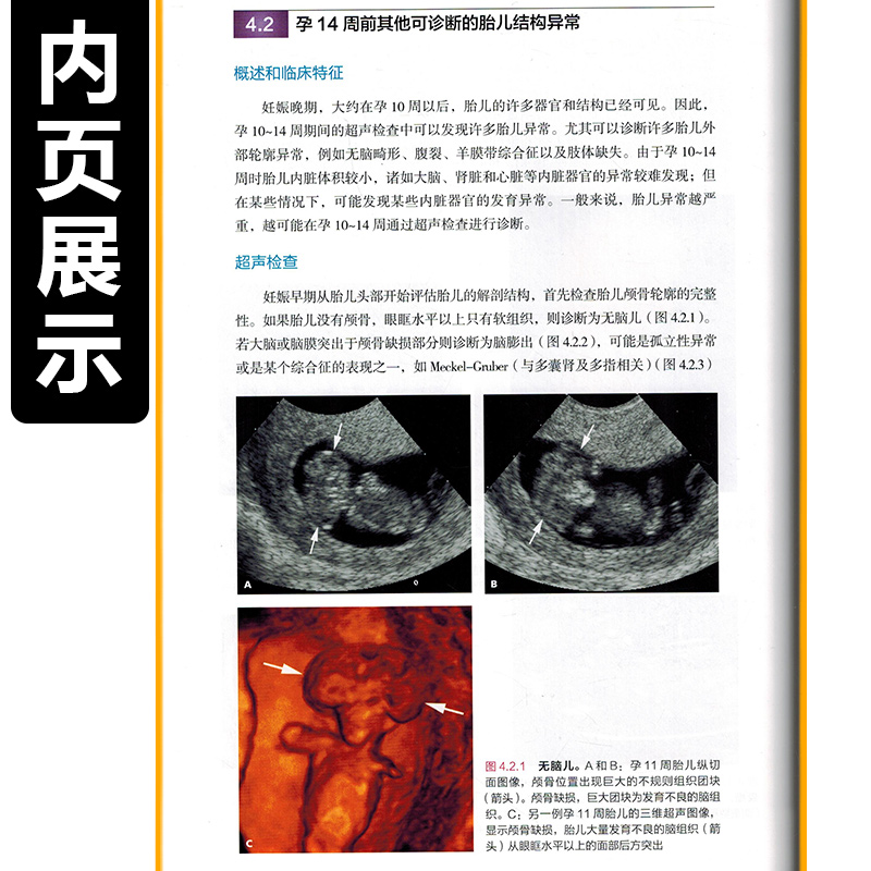[醉染正版]妇产科超声诊断图谱 第三版 妇产科学参考书籍 影像医学参考书籍 Peter M Doubilet等编著 97高清大图
