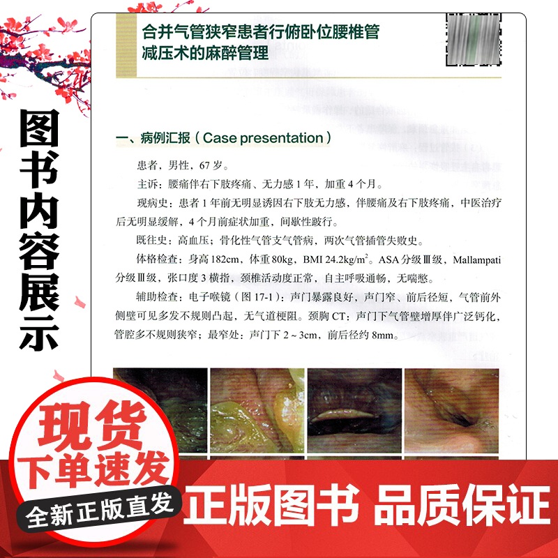 协和麻醉病例讨论(第一辑)中国协和医科大学出版社9787567924772高清大图