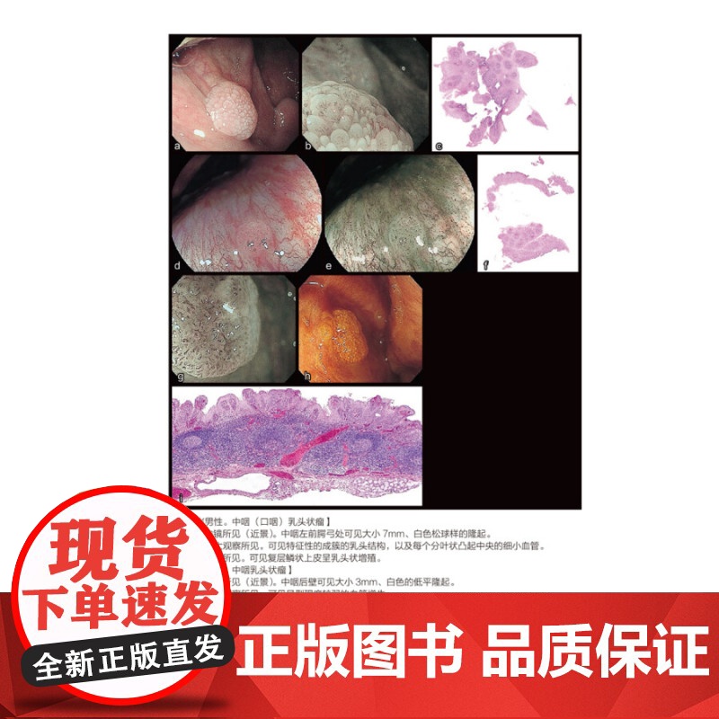 正版 上消化道内镜诊断图谱 详解疾病的诊断要点 配内镜图病理图 内镜操作注意事项 临床医学书籍 中初级内镜医生参考书 辽高清大图