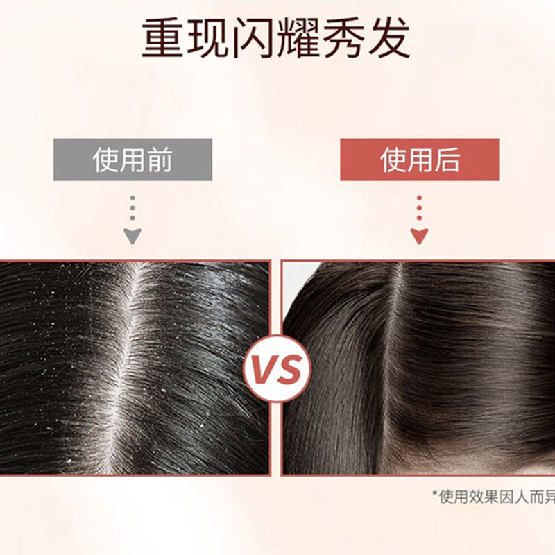 滋源-535ml茶籽水润去屑洗头水(中干性)高清大图