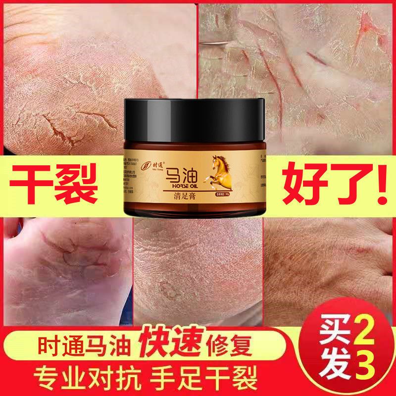 护手霜1支/---\ 马油干裂脚后跟皮手脚干燥开裂手足皲裂防裂膏护手护脚修护霜