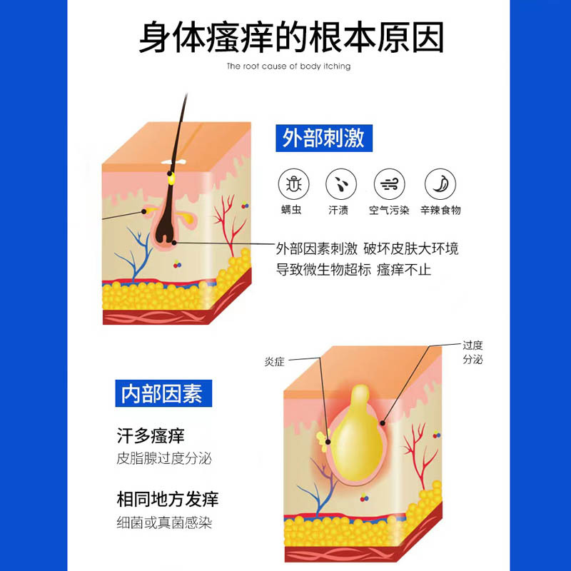 满婷止痒皂108g