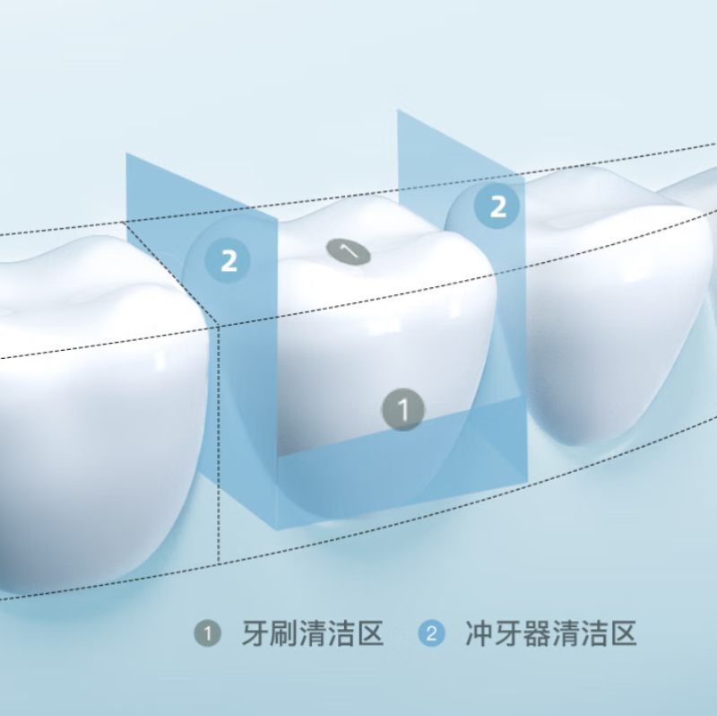 拜尔 M9 小米 蕉便携冲牙器伸缩抽拉式 大水箱 水牙线家用正畸专用口腔清洁洗牙神器 布蕉绿高清大图