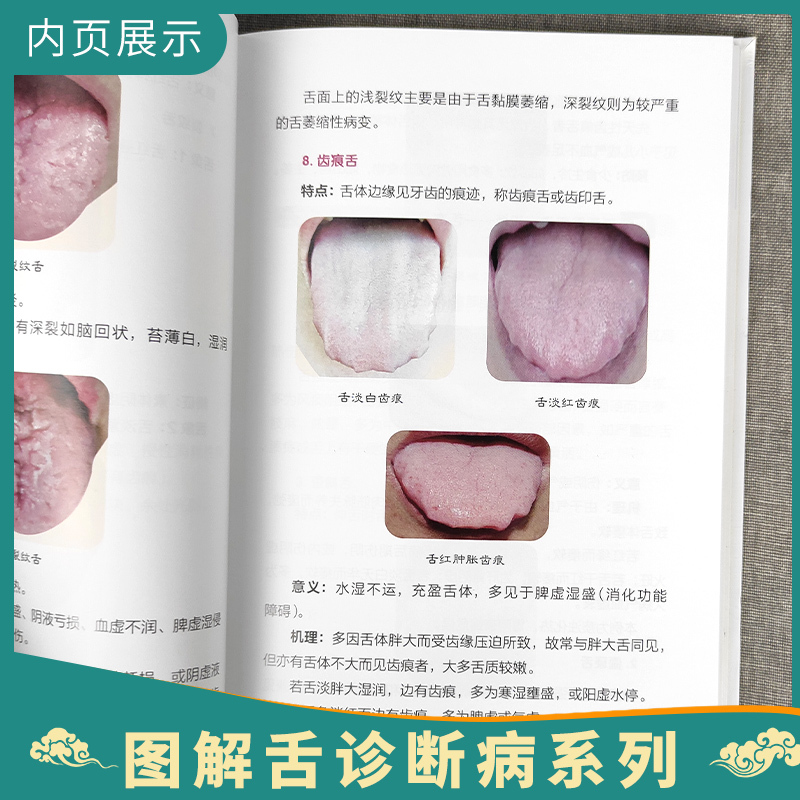 [正版]4本 图解舌诊断病+图解舌诊断病2+图解妇科舌诊断病+图解小儿舌诊与体质 中医临床病症望舌知健康临床实拍彩图人