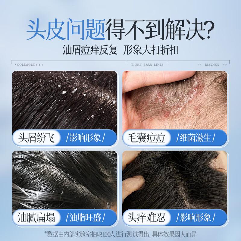 儒意二硫化硒净屑清爽洗发水500ml高清大图