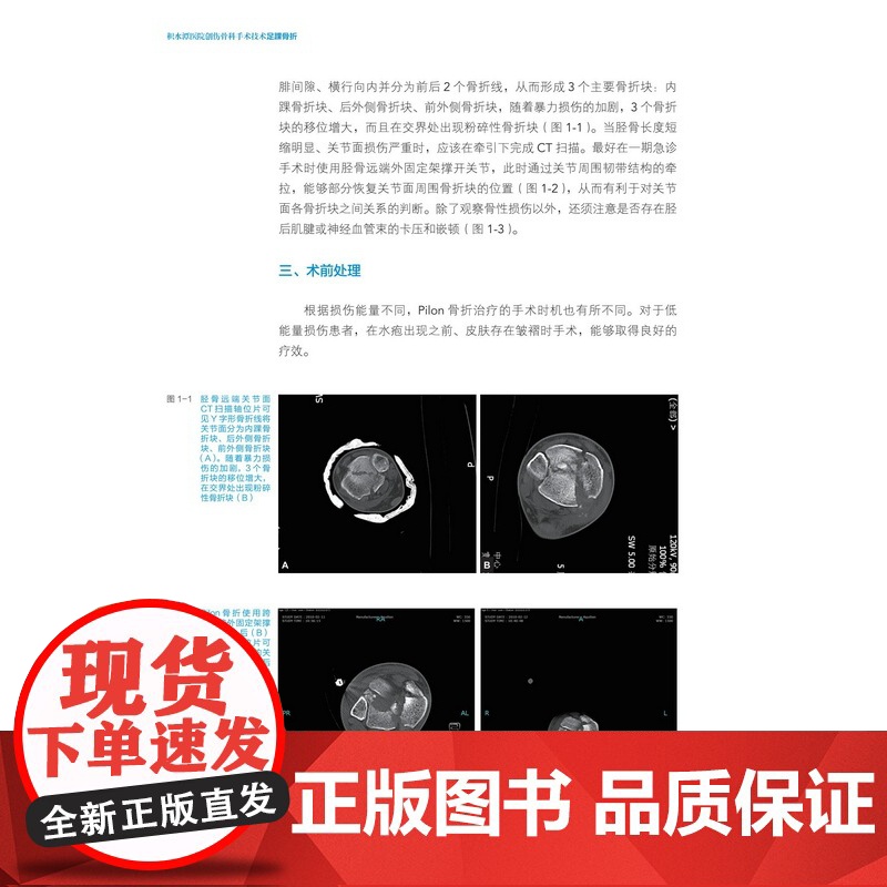 积水潭医院创伤骨科手术技术 足踝骨折 北京积水潭医院手术经验全景展示 北京科学技术高清大图