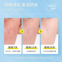 雪玲妃香皂芝士除螨皂洗脸皂洁面皂脸部面部女深层清洁男女100克
