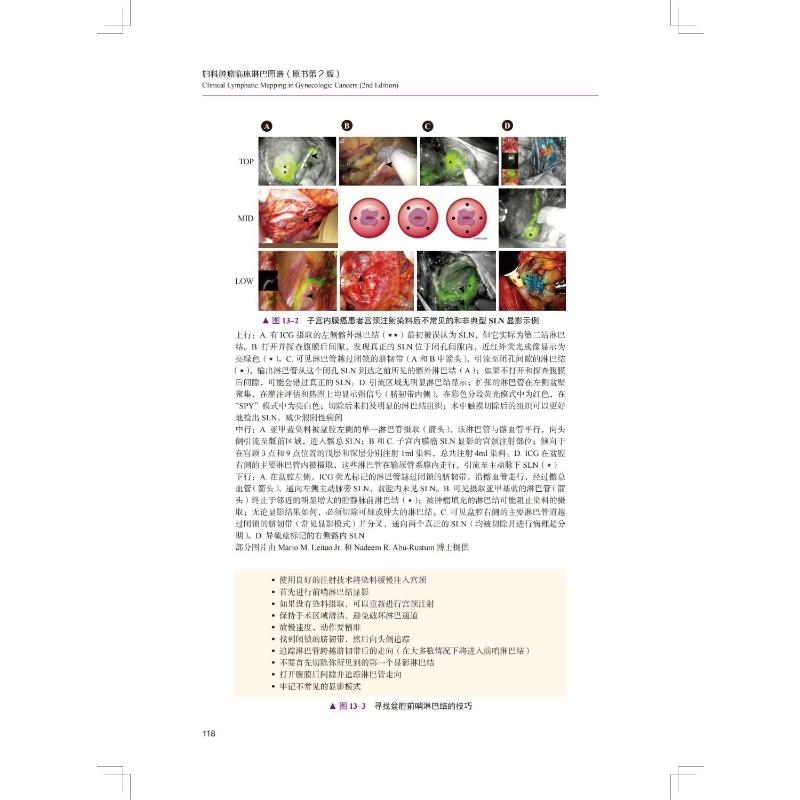 妇科肿瘤临床淋巴图谱(原书第2版)