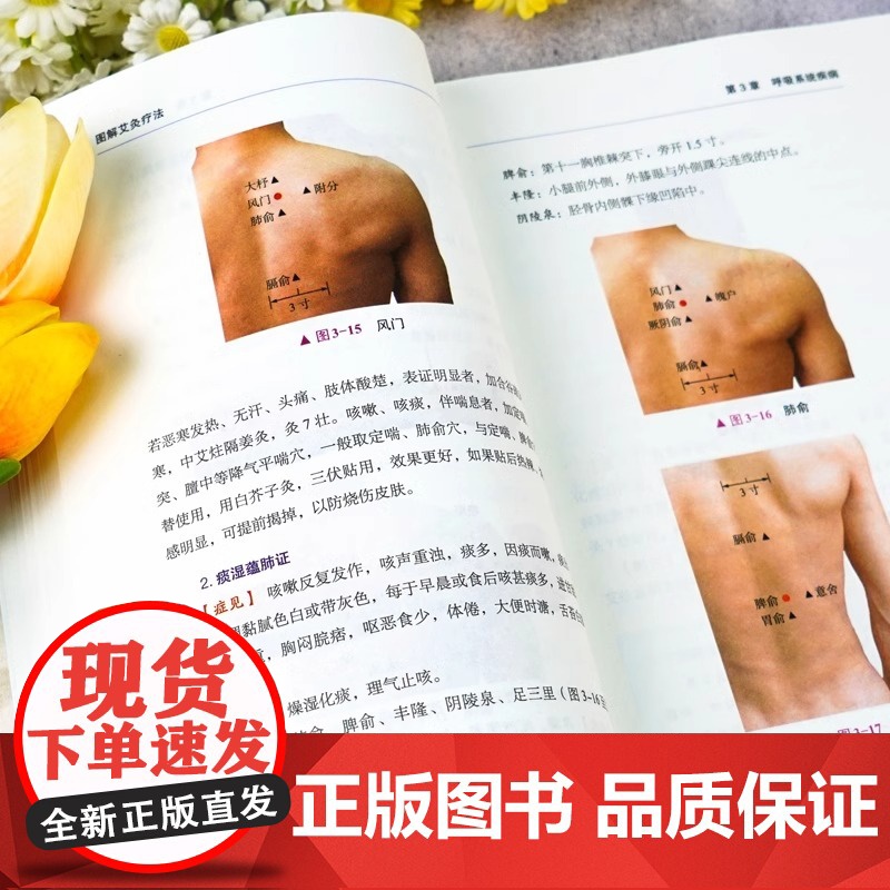 正版 艾灸书籍图解艾灸疗法 初学者基础学中医养生艾灸书籍大全艾灸疗法家用 女人艾条艾灸止痛祛寒湿参考书籍中医书籍针灸疗法高清大图