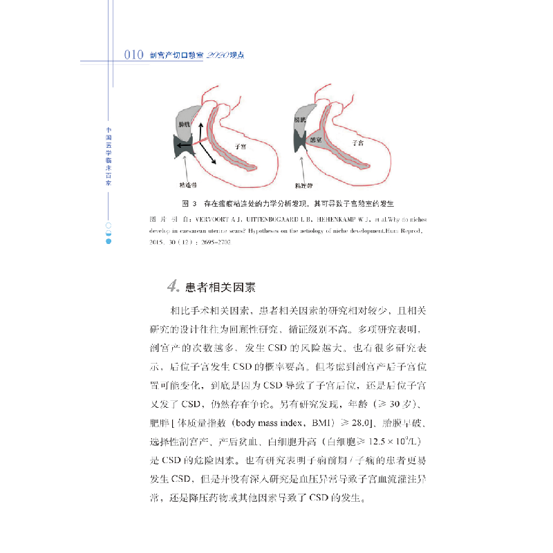 音像剖宫产切口憩室2020观点张健