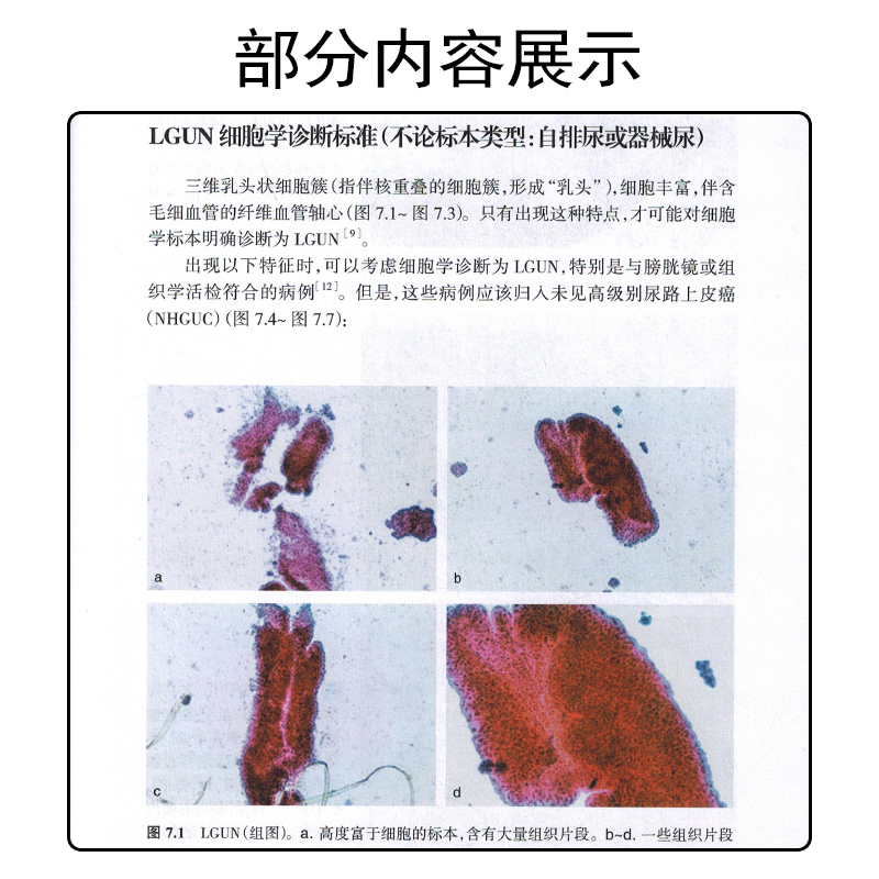 [正版]尿细胞学巴黎报告系统(翻译版)诊断类别、诊断标准尿液标本的满意度评估 尿细胞学辅助检查临床实用书籍 人民卫生出高清大图