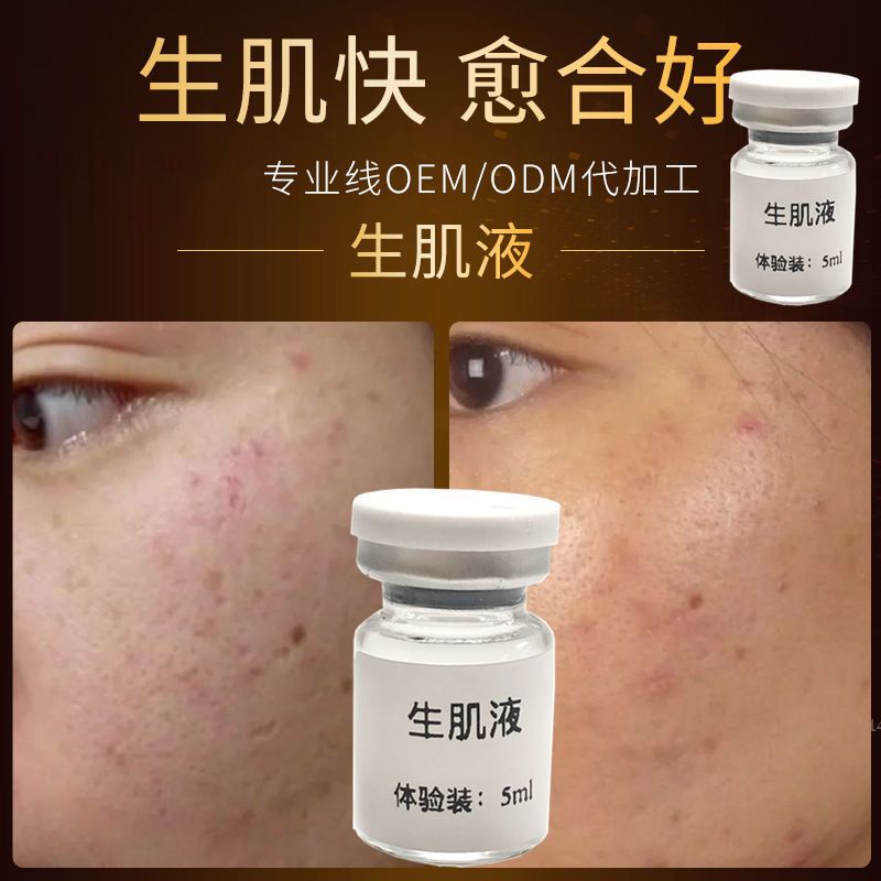 图书>期刊/杂志>男士>图书其它>生肌液修复痘坑凹坑生肌膏促进皮肤