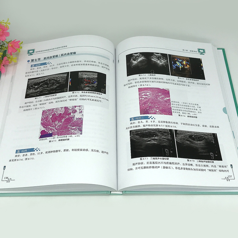 [正版] 浅表软组织疾病超声诊断与病理对照图谱 刘勋 魏玺 临床医学 超声学书籍 9787518973743 科学技术高清大图