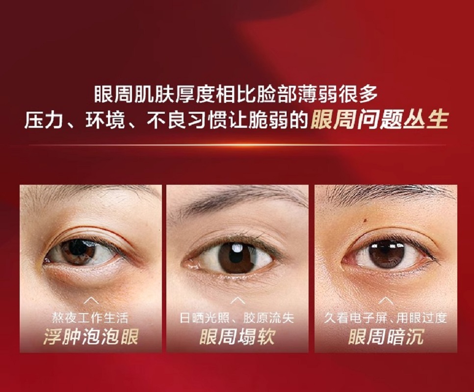 520礼物资生堂红妍肌活红腰子精华眼霜 淡化细纹眼部高清大图