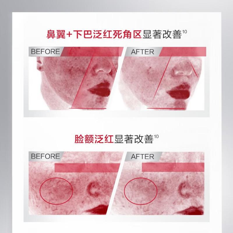 薇诺娜舒缓保湿特护精华液30ml高清大图