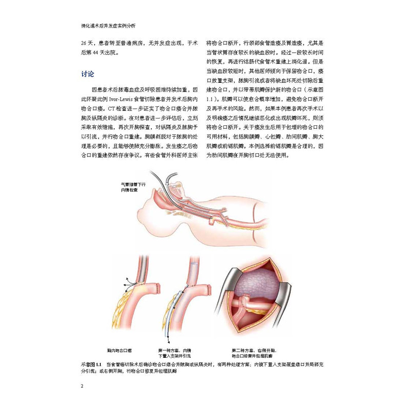 醉染图书消化道术后并发症实例分析9787571412135高清大图