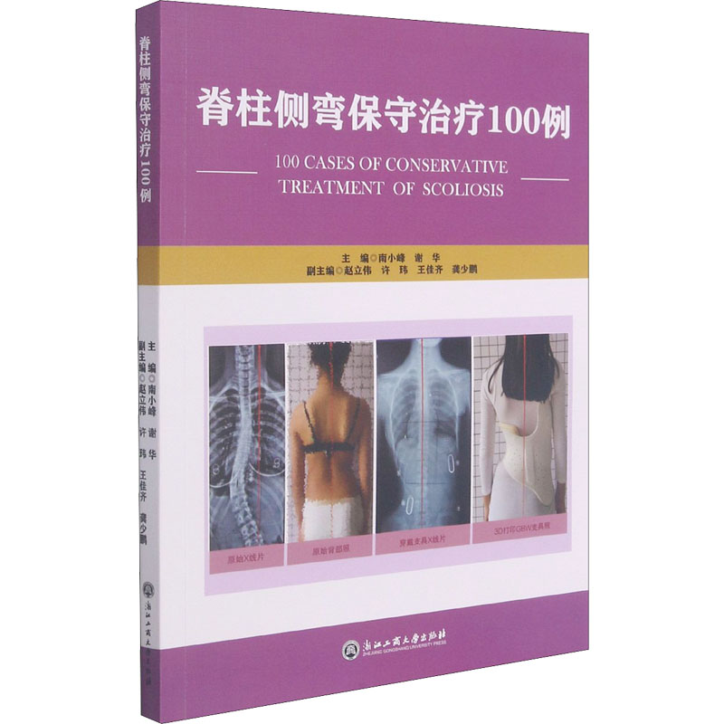 脊柱侧弯保守治疗100例