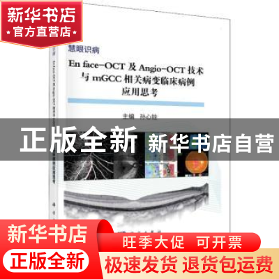 正版 En face-OCT及Angio-OCT技术与mGCC相关病变临床病例应用思